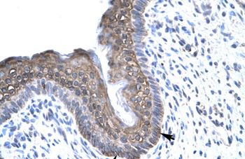 FOXE3 Rabbit Polyclonal Antibody