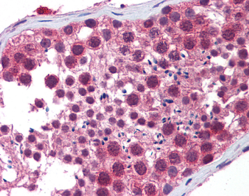 Hdac6 Rabbit Polyclonal Antibody