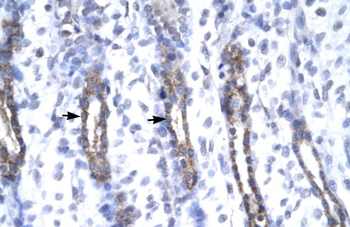 MMP19 Rabbit Polyclonal Antibody