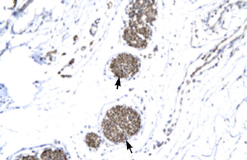 MMP19 Rabbit Polyclonal Antibody