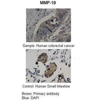 MMP19 Rabbit Polyclonal Antibody