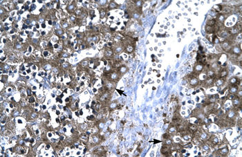 MMP19 Rabbit Polyclonal Antibody
