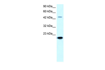 MMP19 Rabbit Polyclonal Antibody
