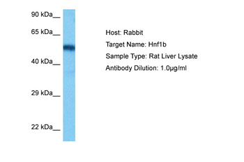 HNF1B Rabbit Polyclonal Antibody