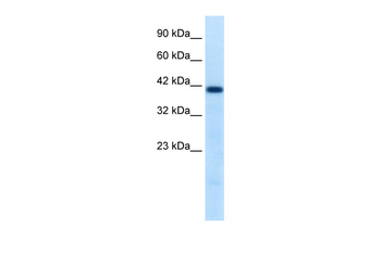 HNF1B Rabbit Polyclonal Antibody
