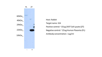 ID4 Rabbit Polyclonal Antibody