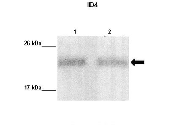 ID4 Rabbit Polyclonal Antibody