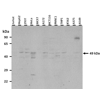 BMP7 Rabbit Polyclonal Antibody