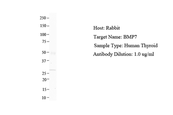 BMP7 Rabbit Polyclonal Antibody