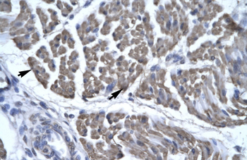 EYA3 Rabbit Polyclonal Antibody