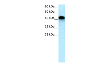 EYA3 Rabbit Polyclonal Antibody