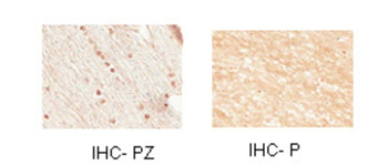 NKX2-2 Rabbit Polyclonal Antibody