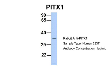 PITX1 Rabbit Polyclonal Antibody