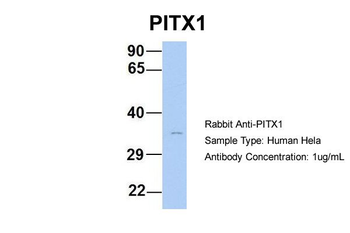 PITX1 Rabbit Polyclonal Antibody