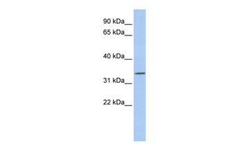 PITX1 Rabbit Polyclonal Antibody