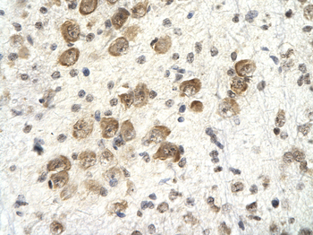 PSMD4 Rabbit Polyclonal Antibody