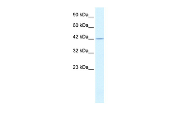 PSMD4 Rabbit Polyclonal Antibody