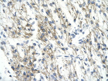 RUVBL1 Rabbit Polyclonal Antibody