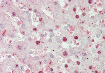 ATOH1 Rabbit Polyclonal Antibody