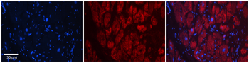 SIX1 Rabbit Polyclonal Antibody