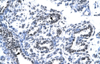 RUVBL2 Rabbit Polyclonal Antibody