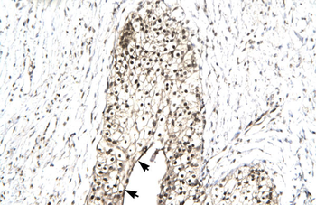 RUVBL2 Rabbit Polyclonal Antibody