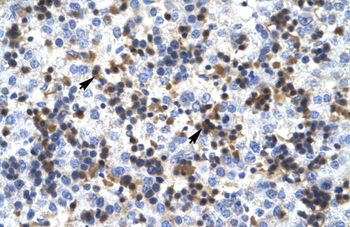 RUVBL2 Rabbit Polyclonal Antibody