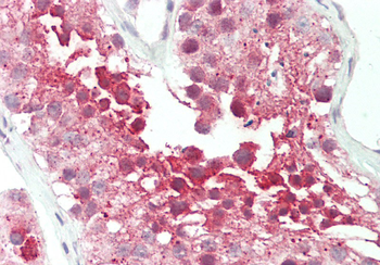 RUVBL2 Rabbit Polyclonal Antibody