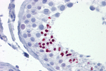 TLE4 Rabbit Polyclonal Antibody