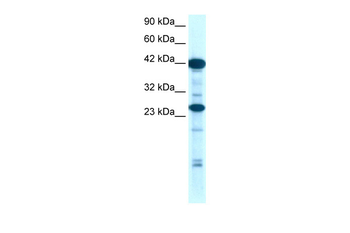 SIX6 Rabbit Polyclonal Antibody