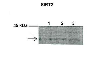 SIRT2 Rabbit Polyclonal Antibody