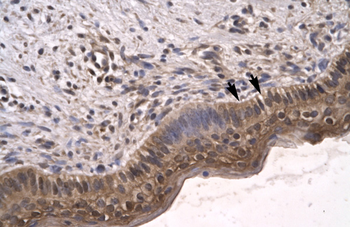 SIRT5 Rabbit Polyclonal Antibody