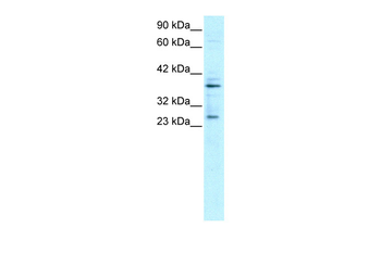 SIRT5 Rabbit Polyclonal Antibody