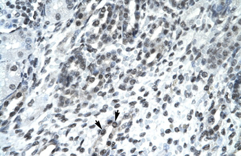 SIRT5 Rabbit Polyclonal Antibody