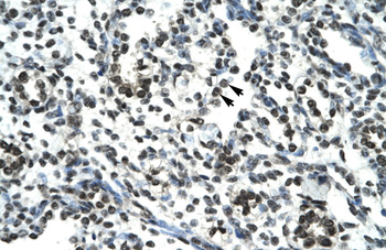 SIRT5 Rabbit Polyclonal Antibody
