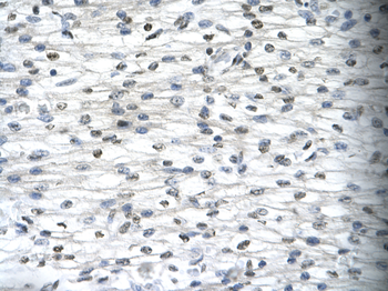 SIRT5 Rabbit Polyclonal Antibody