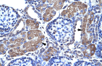 PAX7 Rabbit Polyclonal Antibody