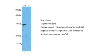 LEF1 Rabbit Polyclonal Antibody