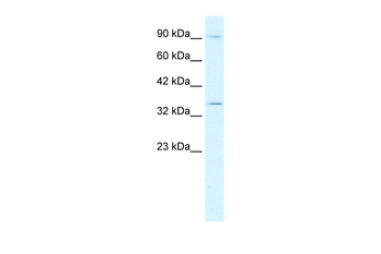 BHLHB5 Rabbit Polyclonal Antibody