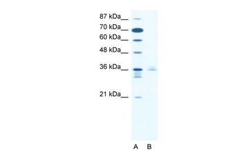 LHX3 Rabbit Polyclonal Antibody
