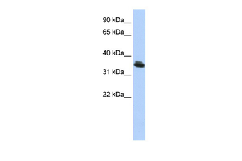 LHX3 Rabbit Polyclonal Antibody