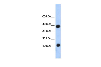 PCBD1 Rabbit Polyclonal Antibody