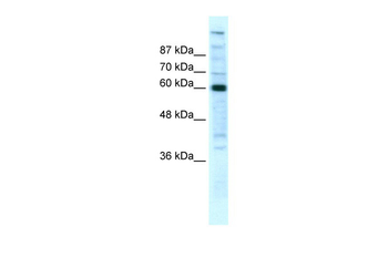 POLR2B Rabbit Polyclonal Antibody