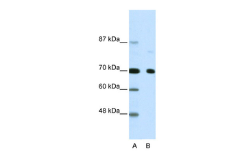 NCOR2 Rabbit Polyclonal Antibody