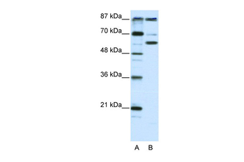 PCAF Rabbit Polyclonal Antibody