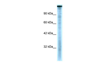 TAF1 Rabbit Polyclonal Antibody