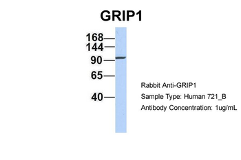 GRIP1 Rabbit Polyclonal Antibody