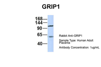 GRIP1 Rabbit Polyclonal Antibody