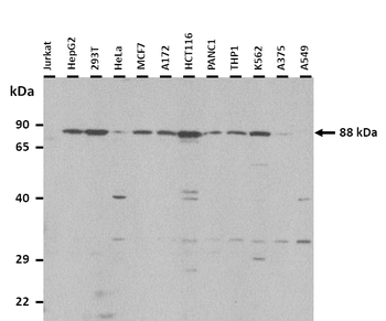 ATMIN Rabbit Polyclonal Antibody
