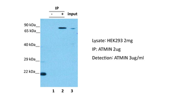ATMIN Rabbit Polyclonal Antibody